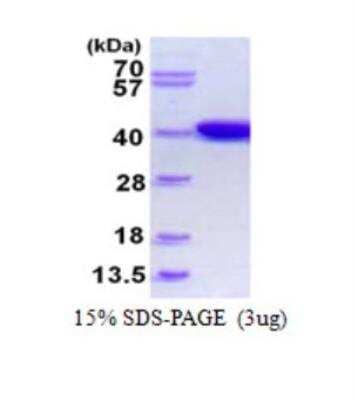 SDS-PAGE: Recombinant E. coli IdHA His Protein [NBP1-98898]