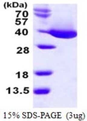 SDS-PAGE: Recombinant E. coli MDH1 His Protein [NBP1-99038]