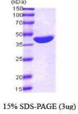 SDS-PAGE: Maltose Binding Protein Recombinant Protein [NBC1-18538]