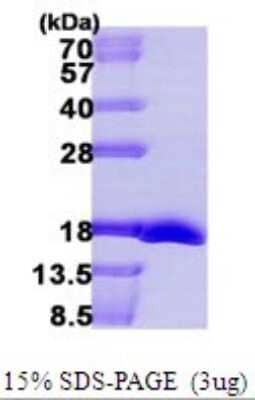 SDS-PAGE: Recombinant E. coli Methionine Sulfoxide Reductase B His Protein [NBP1-72288]