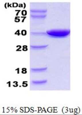 SDS-PAGE: Recombinant E. coli PANK1 His Protein [NBP1-78894]