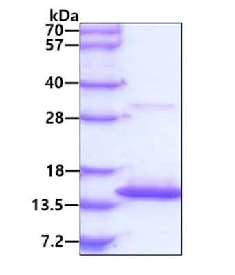 SDS-PAGE: Recombinant E. coli RNase P protein component Protein [NBP3-12867]