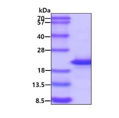 SDS-PAGE: Recombinant E. coli Ribonuclease Inhibitor His Protein [NBP1-72417]