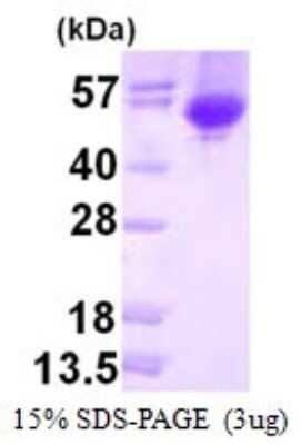 SDS-PAGE: Recombinant E. coli alpha-Galactosidase A/GLA His Protein [NBP1-98992]