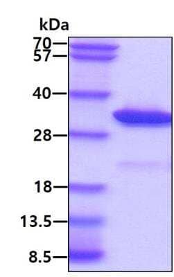 SDS-PAGE: Recombinant E. coli mutM His Protein [NBP2-59512]