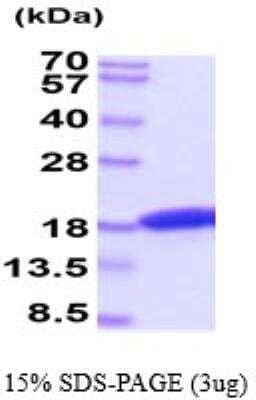 SDS-PAGE: Recombinant Feline IFN-gamma His Protein [NBP2-59507]