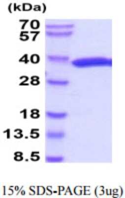 SDS-PAGE: Recombinant Renilla reniformis Luciferase His (N-Term) Protein [NBP2-59648]