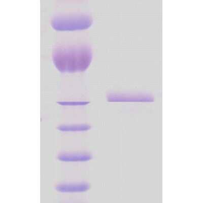 SDS-PAGE: Recombinant HSP65 (mycobacterial) Protein [NBP3-09170]