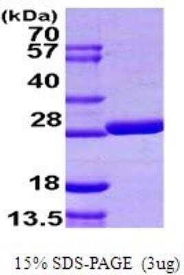 SDS-PAGE: Recombinant E. coli Glutaredoxin 2 His Protein [NBP1-72291]