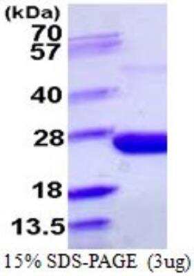 SDS-PAGE: Recombinant E. coli Inorganic Pyrophosphatase/PPA1 His Protein [NBP1-72378]