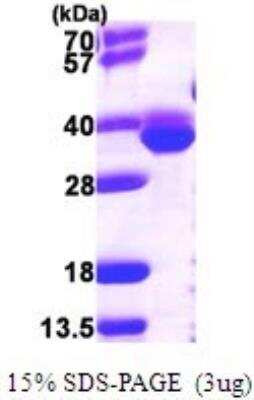 SDS-PAGE: Recombinant E. coli Methionine Aminopeptidase 1/METAP1 His Protein [NBP1-78803]