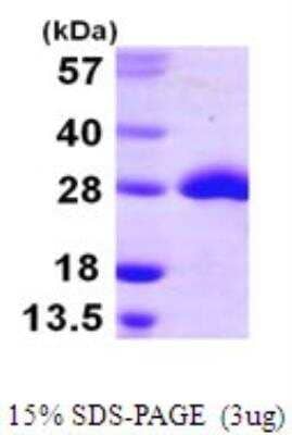 SDS-PAGE: Recombinant E. coli Methionine Sulfoxide Reductase A His Protein [NBP1-72289]