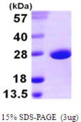 SDS-PAGE: Recombinant E. coli SOD1/Cu-Zn SOD His Protein [NBP1-72290]