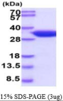 SDS-PAGE: Recombinant Mouse 15-PGDH/HPGD His Protein [NBP2-59522]