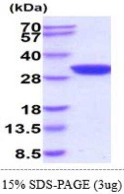 SDS-PAGE: Recombinant Mouse AK2 His Protein [NBP2-61201]