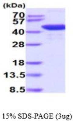 SDS-PAGE: Recombinant Mouse Histone Deacetylase 8/HDAC8 His Protein [NBP2-59518]