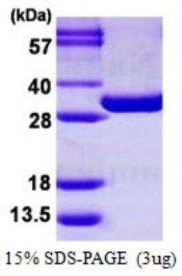 SDS-PAGE: Recombinant Mouse PGAM1 His Protein [NBP1-99029]