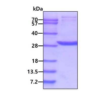 SDS-PAGE: Recombinant Human 14-3-3 beta/alpha Protein [NBC1-18405]