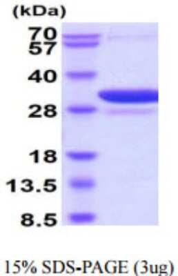 SDS-PAGE: Recombinant Human 14-3-3 beta/alpha His Protein [NBP2-59657]