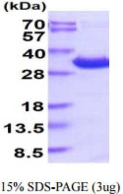 SDS-PAGE: Recombinant Human 14-3-3 epsilon His Protein [NBP2-59654]