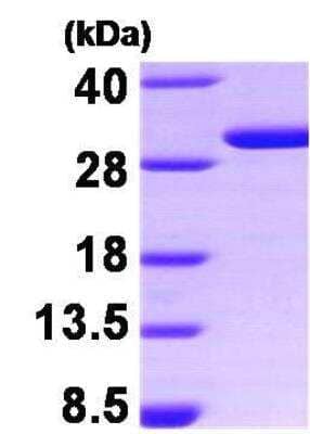 SDS-PAGE: Recombinant Human 14-3-3 sigma/Stratifin Protein [NBP1-30172]