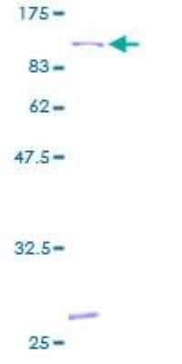 SDS-PAGE: Recombinant Human 15-Lipoxygenase 1 GST (N-Term) Protein [H00000246-P01]