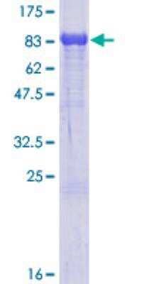 SDS-PAGE: Recombinant Human 15-Lipoxygenase 2 GST (N-Term) Protein [H00000247-P01]