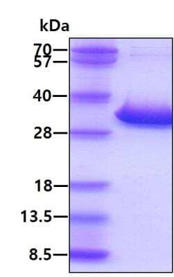 SDS-PAGE: Recombinant Human 17 beta-HSD14/HSD17B14 His Protein [NBP1-50884]