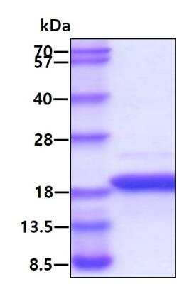 SDS-PAGE: Recombinant Human 4EBP1 His Protein [NBP1-30218]