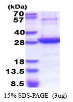 SDS-PAGE: Recombinant Human 5'-Nucleotidase/CD73 His Protein [NBP2-51548]