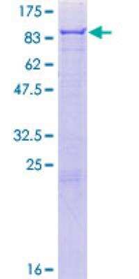 SDS-PAGE: Recombinant Human 5-Lipoxygenase GST (N-Term) Protein [H00000240-P01]