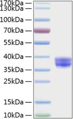 SDS-PAGE: Recombinant Human A33/GPA33 His (C-Term) Protein [NBP3-18201]