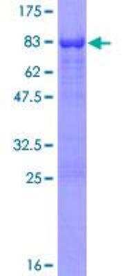 SDS-PAGE: Recombinant Human AAK1 GST (N-Term) Protein [H00022848-P01]