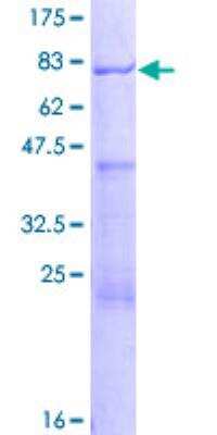 SDS-PAGE: Recombinant Human AAMP GST (N-Term) Protein [H00000014-P01]