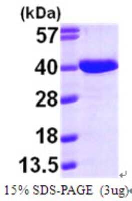 SDS-PAGE: Recombinant Human AASD-PPT His Protein [NBP1-49307]