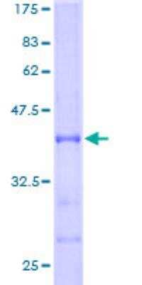 SDS-PAGE: Recombinant Human ABAT GST (N-Term) Protein [H00000018-P01]