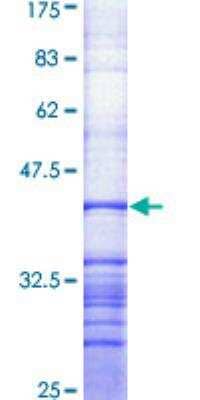 SDS-PAGE: Recombinant Human ABCA1 GST (N-Term) Protein [H00000019-Q01]