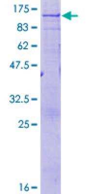 SDS-PAGE: Recombinant Human ABCD1 GST (N-Term) Protein [H00000215-P01]