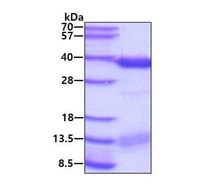 SDS-PAGE: Recombinant Human ABH2 His Protein [NBP1-72287]