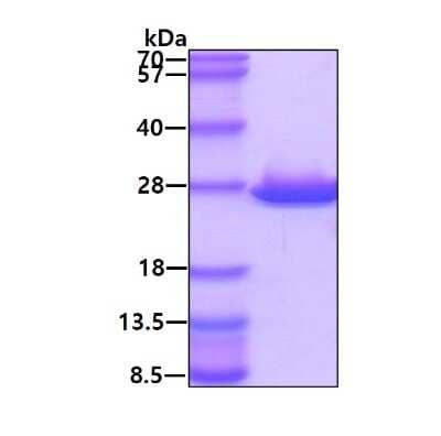 SDS-PAGE: Recombinant Human ABHD14B His Protein [NBP1-78893]