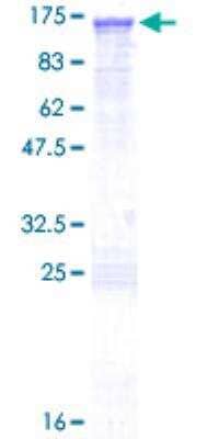 SDS-PAGE: Recombinant Human ABR GST (N-Term) Protein [H00000029-P01]