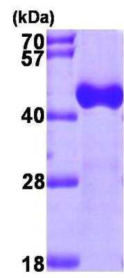 SDS-PAGE: Recombinant Human ACAA1 His Protein [NBP1-45323]