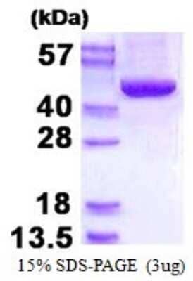 SDS-PAGE: Recombinant Human ACADSB His Protein [NBP1-98904]