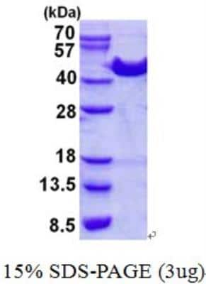 SDS-PAGE: Recombinant Human ACAT1 His Protein [NBP2-22664]