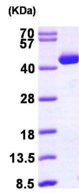 SDS-PAGE: Recombinant Human ACAT2 His Protein [NBP1-45287]