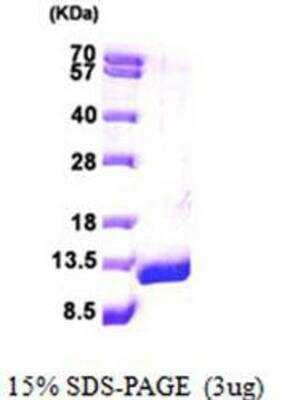 SDS-PAGE: Recombinant Human ACBP His Protein [NBP1-50833]