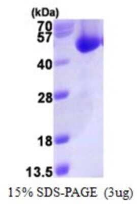 SDS-PAGE: Recombinant Human ACOT7 His Protein [NBP1-78839]