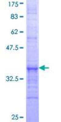 SDS-PAGE: Recombinant Human ACOX3 GST (N-Term) Protein [H00008310-Q01]