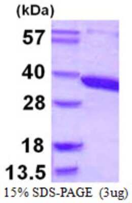 SDS-PAGE: Recombinant Human ACY3 His Protein [NBP1-72381]