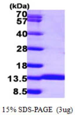 SDS-PAGE: Recombinant Human ACYP1 His Protein [NBP1-51005]